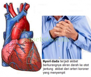 Penyakit jantung koroner