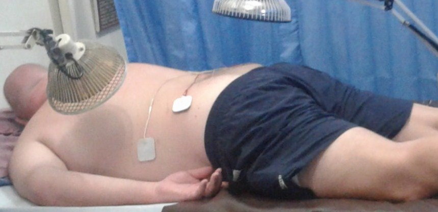 Cara Mengobati Asam Lambung dengan Akupuntur dan Herbal di Jakarta