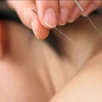Cara Mengobati Cegukan dengan Terapi Akupuntur