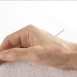 Cara Mengobati Mual dengan Terapi Akupuntur