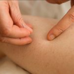 Cara Mengobati Otot Kaku dengan Terapi Akupuntur