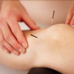Nyeri Otot Diatasi Dengan Mudah Melalui Terapi Akupuntur