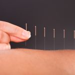 Gejala Asam Urat dan Cara Terapi dengan Akupuntur
