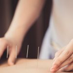 Gejala Gerd dan Cara Terapi dengan Akupuntur