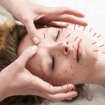 Gejala Mulut Miring dan Cara Terapi dengan Akupuntur