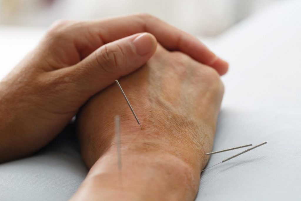 Biaya Terapi Tusuk Jarum Stroke