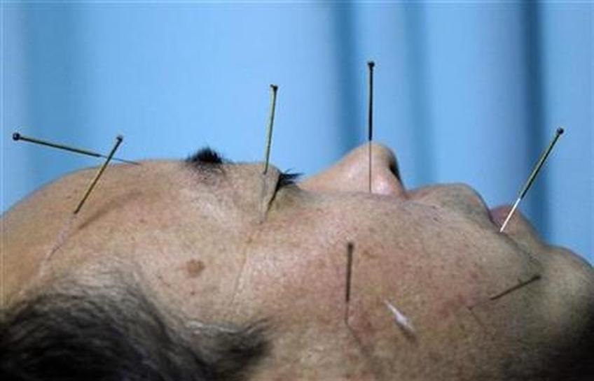 Tusuk Jarum Untuk Stroke Di Tangerang
