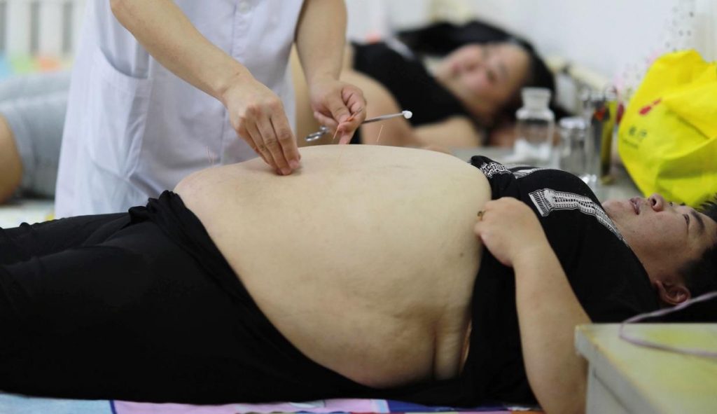 Pantangan Makanan Penderita Obesitas