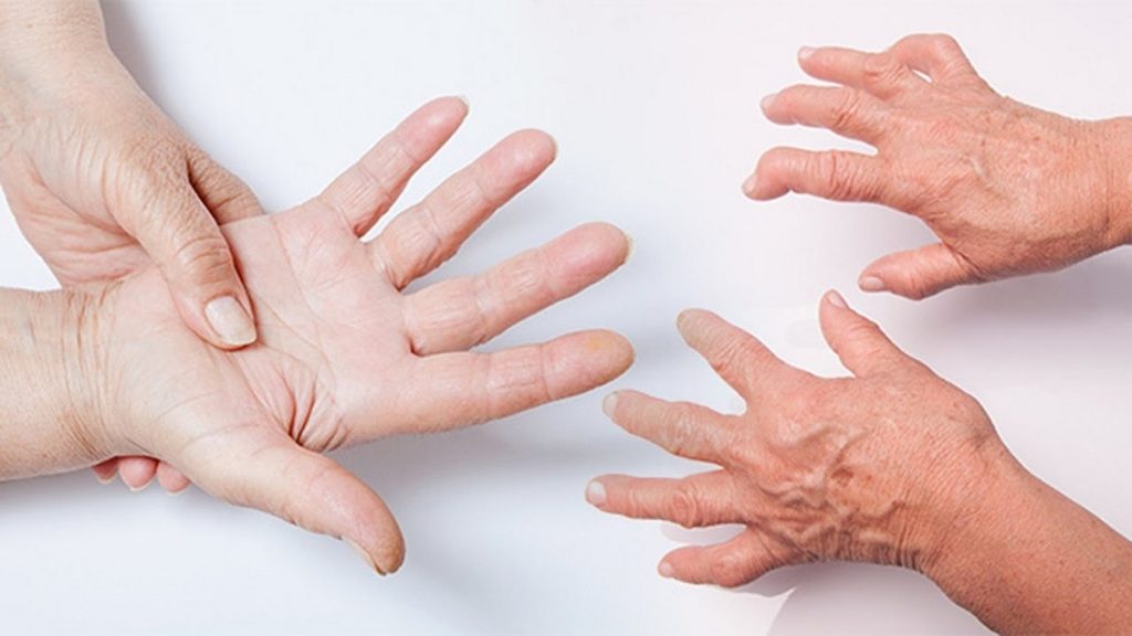 Pantangan Makanan Penderita Radang Sendi