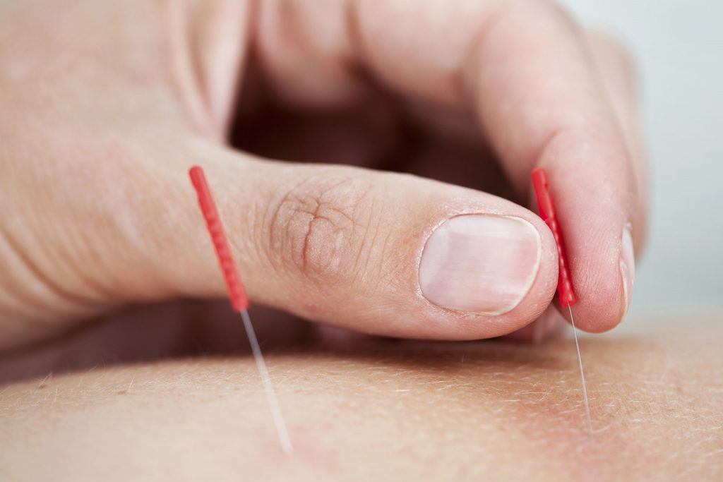 Pertolongan Pertama Pada Gejala Stroke Ringan