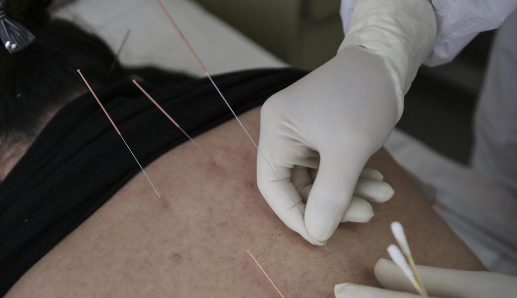 Manfaat Terapi Akupuntur untuk Daya Tahan Tubuh Tetap Fit