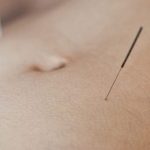 Terapi Akupuntur untuk Mengobati Gangguan Pencernaan