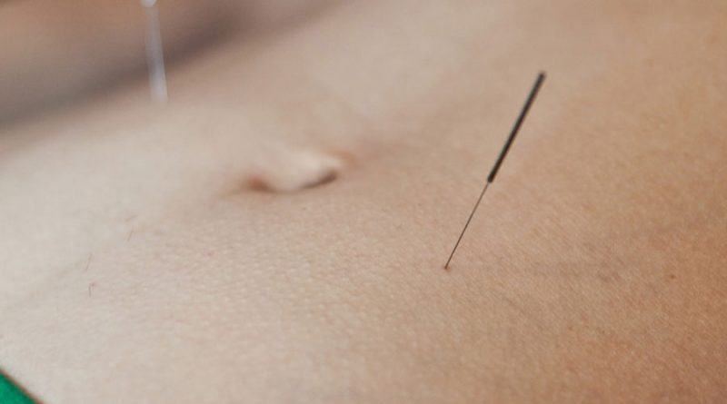 Terapi Akupuntur untuk Mengobati Gangguan Pencernaan