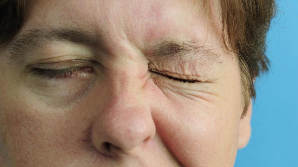 Tempat Pengobatan Alternatif untuk Bell Palsy