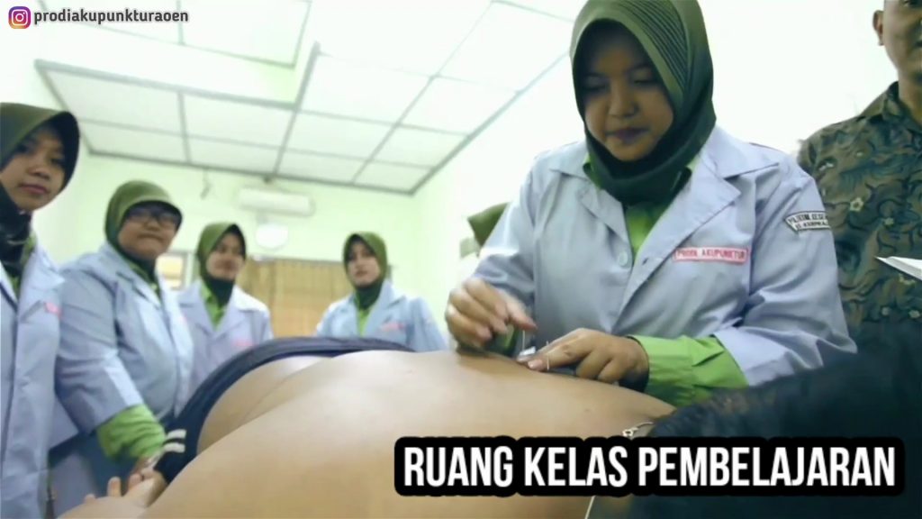 Tempat Belajar Akupunktur di Malang