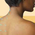 Tempat Terapi Stroke Berpengalaman di Tangerang