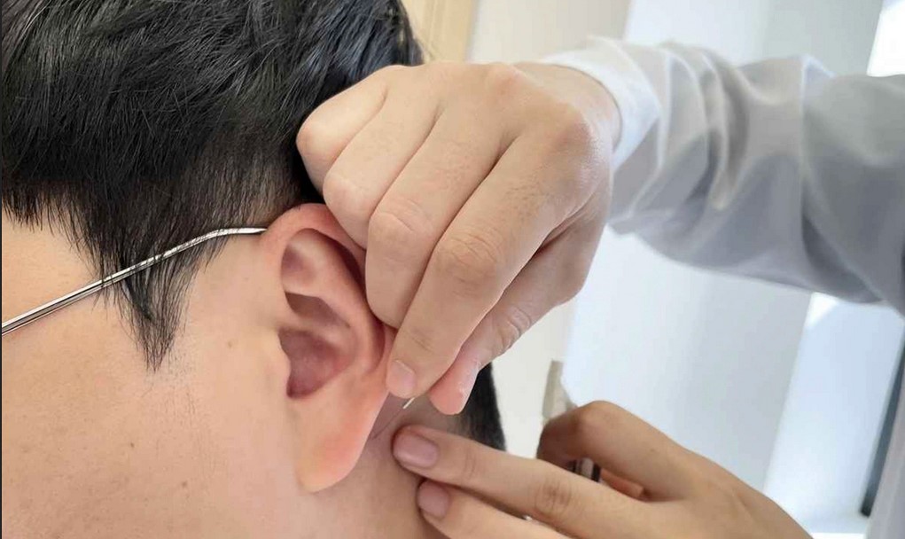 Pengobatan Akupuntur untuk Stroke di Graha Raya Serpong