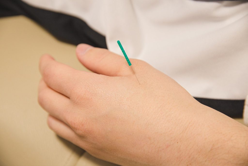 Terapi Stroke Ringan Sekitar Graha Raya