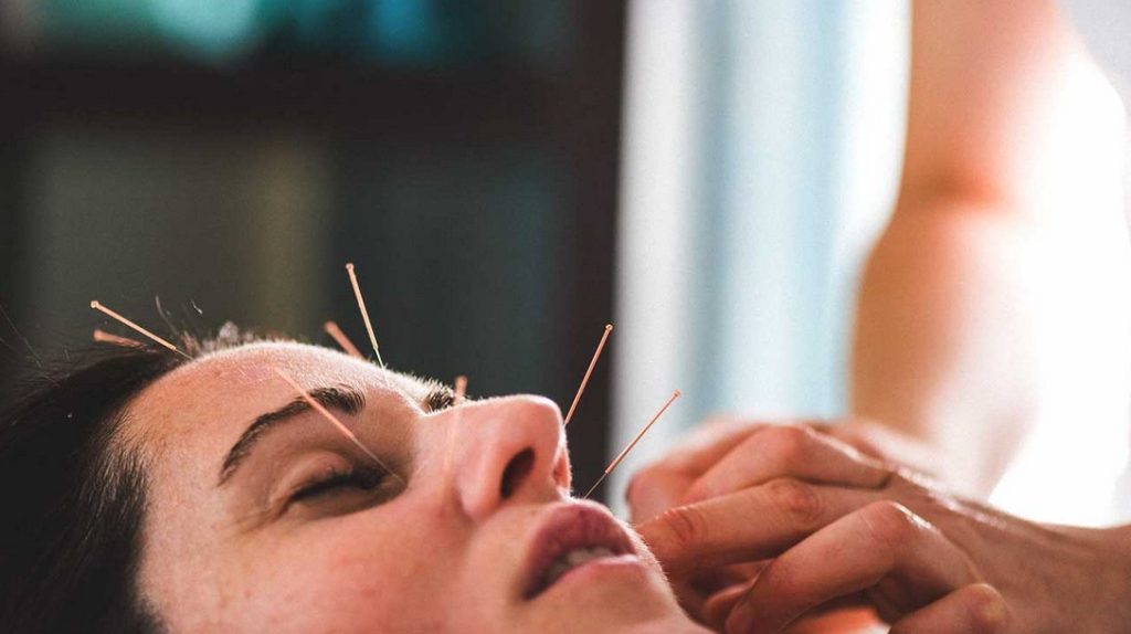 Cara Mengobati Mulut Miring Belspalsi dengan Akupuntur dan Herbal di Tangerang