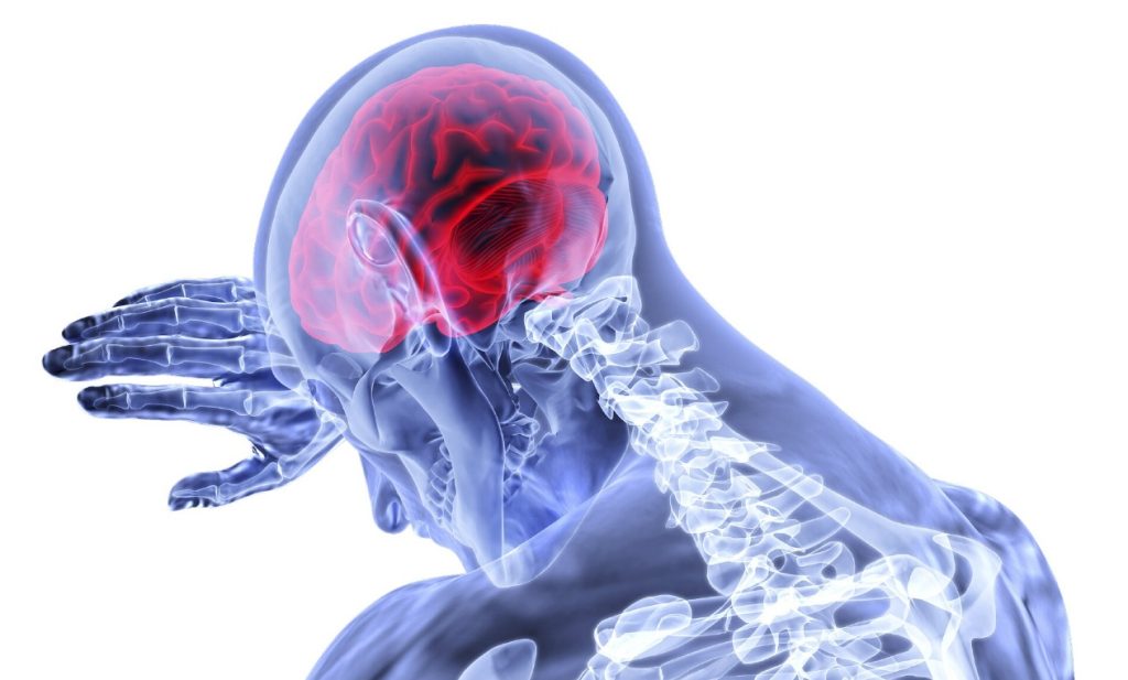 Harga Angkung Niu Huang Wan Asli Berapa Kenali Manfaatnya untuk Stroke Iskemik & Hemoragik