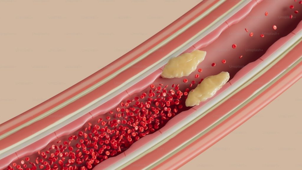 Harga Angkung Niu Huang Wan Terbaru Hari Ini dan Manfaatnya untuk Menjaga Pembuluh Darah