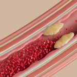 Harga Angkung Niu Huang Wan Terbaru Hari Ini dan Manfaatnya untuk Menjaga Pembuluh Darah