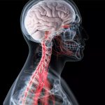 Manfaat Angkung Niu Huang Wan Asli Perlindungan Otak dari Stroke Mendadak