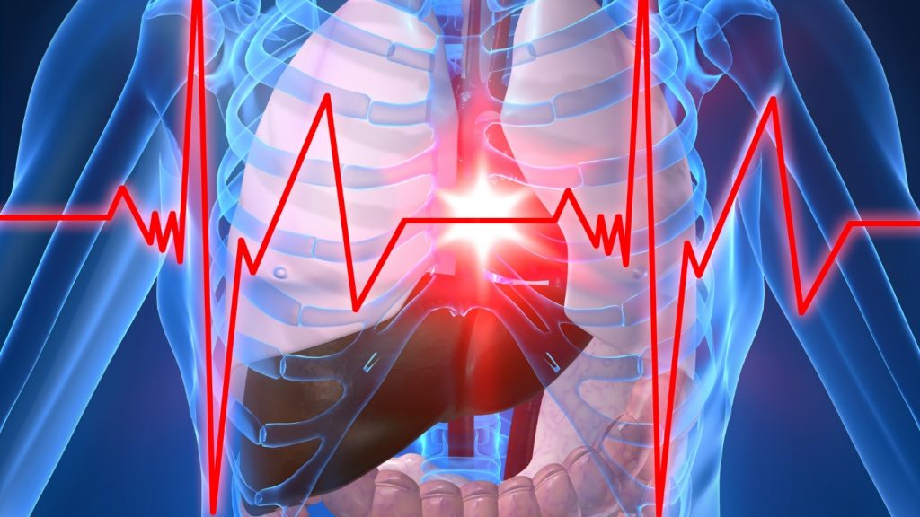 Obat Stroke China Paling Ampuh untuk Cegah Stroke Mendadak pada Penderita Jantung