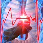 Obat Stroke China Paling Ampuh untuk Cegah Stroke Mendadak pada Penderita Jantung