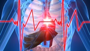 Obat Stroke China Paling Ampuh untuk Cegah Stroke Mendadak pada Penderita Jantung