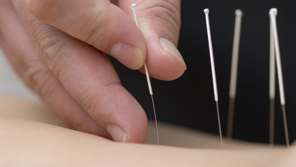 An Gong Niu Huang Wan Original + Akupunktur Klinik Alfarisy Lawan Risiko Stroke Berulang Sekarang