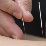 An Gong Niu Huang Wan Original + Akupunktur Klinik Alfarisy: Lawan Risiko Stroke Berulang Sekarang