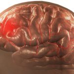 An Gong Niu Huang Wan Original Asli atau Palsu? Kesalahan Ini Bisa Berakibat Fatal bagi Pasien Stroke