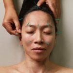 Obat Stroke China Paling Ampuh yang Dikombinasikan dengan Akupunktur untuk Hasil Lebih Optimal